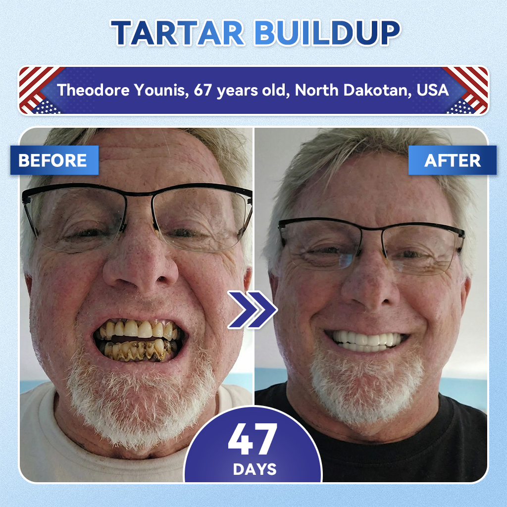 |🇺🇸 𝐎𝐟𝐟𝐢𝐜𝐢𝐚𝐥 𝐔𝐒 𝐒𝐭𝐨𝐫𝐞 | 𝐙𝐔𝐄𝐄𝐓® 🦷 Tideglusib Fast‑Dissolving Tooth & Gum Repair Oral Strips ✨ (Supports tooth repair and helps relieve gum discomfort and other common oral concerns)