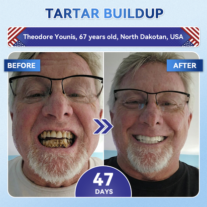 |🇺🇸 𝐎𝐟𝐟𝐢𝐜𝐢𝐚𝐥 𝐔𝐒 𝐒𝐭𝐨𝐫𝐞 | 𝐙𝐔𝐄𝐄𝐓® 🦷 Tideglusib Fast‑Dissolving Tooth & Gum Repair Oral Strips ✨ (Supports tooth repair and helps relieve gum discomfort and other common oral concerns)