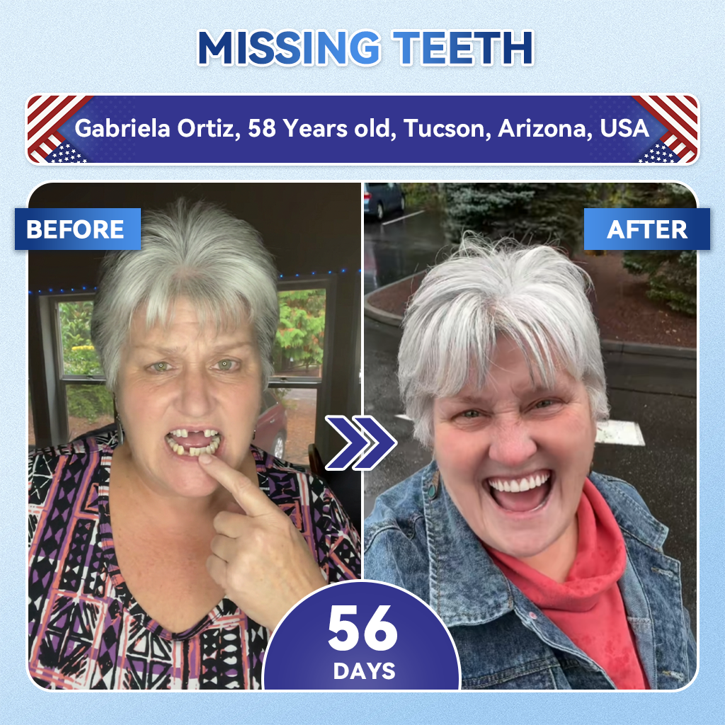 |🇺🇸 𝐎𝐟𝐟𝐢𝐜𝐢𝐚𝐥 𝐔𝐒 𝐒𝐭𝐨𝐫𝐞 | 𝐙𝐔𝐄𝐄𝐓® 🦷 Tideglusib Fast‑Dissolving Tooth & Gum Repair Oral Strips ✨ (Supports tooth repair and helps relieve gum discomfort and other common oral concerns)