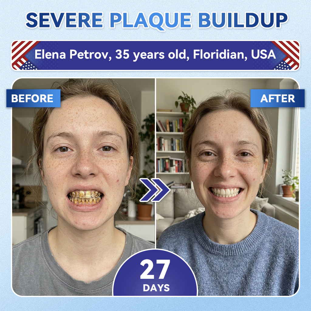 |🇺🇸 𝐎𝐟𝐟𝐢𝐜𝐢𝐚𝐥 𝐔𝐒 𝐒𝐭𝐨𝐫𝐞 | 𝐙𝐔𝐄𝐄𝐓® 🦷 Tideglusib Fast‑Dissolving Tooth & Gum Repair Oral Strips ✨ (Supports tooth repair and helps relieve gum discomfort and other common oral concerns)