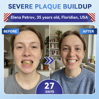 |🇺🇸 𝐎𝐟𝐟𝐢𝐜𝐢𝐚𝐥 𝐔𝐒 𝐒𝐭𝐨𝐫𝐞 | 𝐙𝐔𝐄𝐄𝐓® 🦷 Tideglusib Fast‑Dissolving Tooth & Gum Repair Oral Strips ✨ (Supports tooth repair and helps relieve gum discomfort and other common oral concerns)