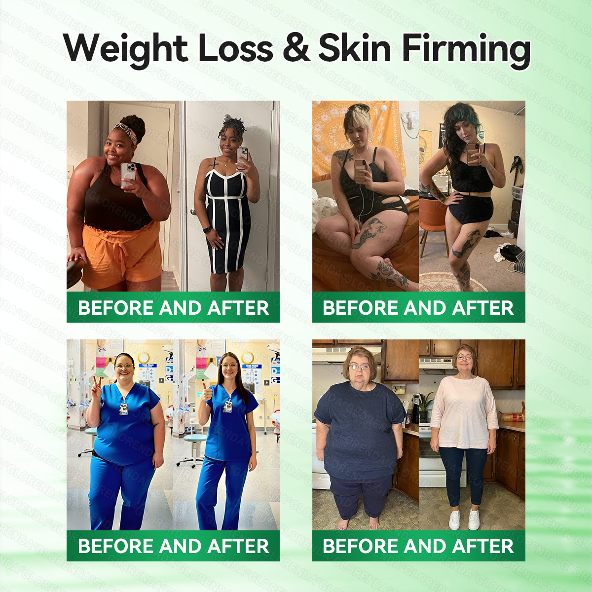 𝑶𝒇𝒇𝒊𝒄𝒊𝒂𝒍 𝑺𝒕𝒐𝒓𝒆  |🍀🍀𝐂𝐚𝐫𝐞𝐔𝐩𝐥𝐢𝐟𝐭® 𝑴𝒆𝒕𝒂𝒃𝒐𝒍𝒊𝒄 𝑵𝒂𝒏𝒐 𝑴𝒊𝒄𝒓𝒐𝒏𝒆𝒆𝒅𝒍𝒆 𝑷𝒂𝒕𝒄𝒉🇺🇸(𝐉𝐮𝐬𝐭 𝐨𝐧𝐜𝐞 𝐚 𝐝𝐚𝐲, 𝐯𝐢𝐬𝐢𝐛𝐥𝐞 𝐜𝐡𝐚𝐧𝐠𝐞𝐬 𝐢𝐧 𝟕 𝐝𝐚𝐲𝐬）𝘽𝙚𝙧𝙗𝙚𝙧𝙞𝙣𝙚 + 𝙈𝙤𝙧𝙞𝙣𝙜𝙖 𝙁𝙤𝙧𝙢𝙪𝙡𝙖 ✅ 𝐅𝐨𝐫 𝐨𝐛𝐞𝐬𝐢𝐭𝐲, 𝗟𝗼𝗼𝘀𝗲 𝘀𝗸𝗶𝗻,𝐝𝐢𝐚𝐛𝐞𝐭𝐞𝐬, 𝐬𝐥𝐞𝐞𝐩 𝐚𝐩𝐧𝐞𝐚, 𝐣𝐨𝐢𝐧𝐭 𝐢𝐬𝐬𝐮𝐞𝐬, 𝐚𝐧𝐝 𝐦𝐨𝐫𝐞💯