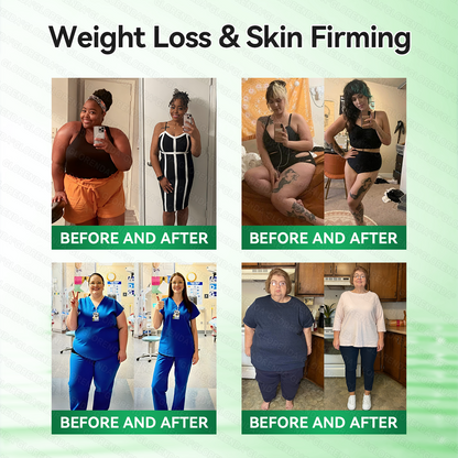 𝑶𝒇𝒇𝒊𝒄𝒊𝒂𝒍 𝑺𝒕𝒐𝒓𝒆  |🍀🍀𝐂𝐚𝐫𝐞𝐔𝐩𝐥𝐢𝐟𝐭® 𝑴𝒆𝒕𝒂𝒃𝒐𝒍𝒊𝒄 𝑵𝒂𝒏𝒐 𝑴𝒊𝒄𝒓𝒐𝒏𝒆𝒆𝒅𝒍𝒆 𝑷𝒂𝒕𝒄𝒉🇺🇸(𝐉𝐮𝐬𝐭 𝐨𝐧𝐜𝐞 𝐚 𝐝𝐚𝐲, 𝐯𝐢𝐬𝐢𝐛𝐥𝐞 𝐜𝐡𝐚𝐧𝐠𝐞𝐬 𝐢𝐧 𝟕 𝐝𝐚𝐲𝐬）𝘽𝙚𝙧𝙗𝙚𝙧𝙞𝙣𝙚 + 𝙈𝙤𝙧𝙞𝙣𝙜𝙖 𝙁𝙤𝙧𝙢𝙪𝙡𝙖 ✅ 𝐅𝐨𝐫 𝐨𝐛𝐞𝐬𝐢𝐭𝐲, 𝗟𝗼𝗼𝘀𝗲 𝘀𝗸𝗶𝗻,𝐝𝐢𝐚𝐛𝐞𝐭𝐞𝐬, 𝐬𝐥𝐞𝐞𝐩 𝐚𝐩𝐧𝐞𝐚, 𝐣𝐨𝐢𝐧𝐭 𝐢𝐬𝐬𝐮𝐞𝐬, 𝐚𝐧𝐝 𝐦𝐨𝐫𝐞💯
