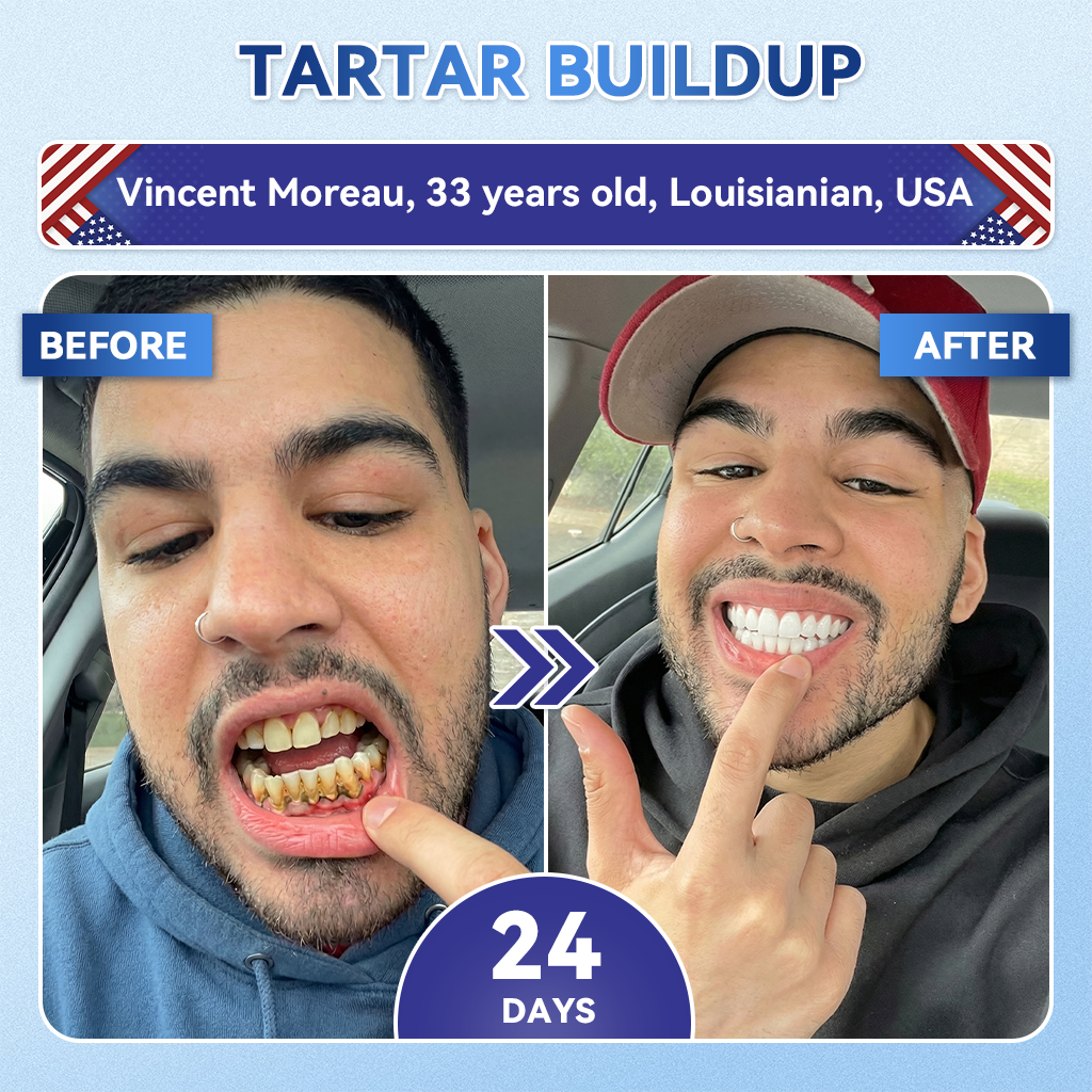 |🇺🇸 𝐎𝐟𝐟𝐢𝐜𝐢𝐚𝐥 𝐔𝐒 𝐒𝐭𝐨𝐫𝐞 | 𝐙𝐔𝐄𝐄𝐓® 🦷 Tideglusib Fast‑Dissolving Tooth & Gum Repair Oral Strips ✨ (Supports tooth repair and helps relieve gum discomfort and other common oral concerns)