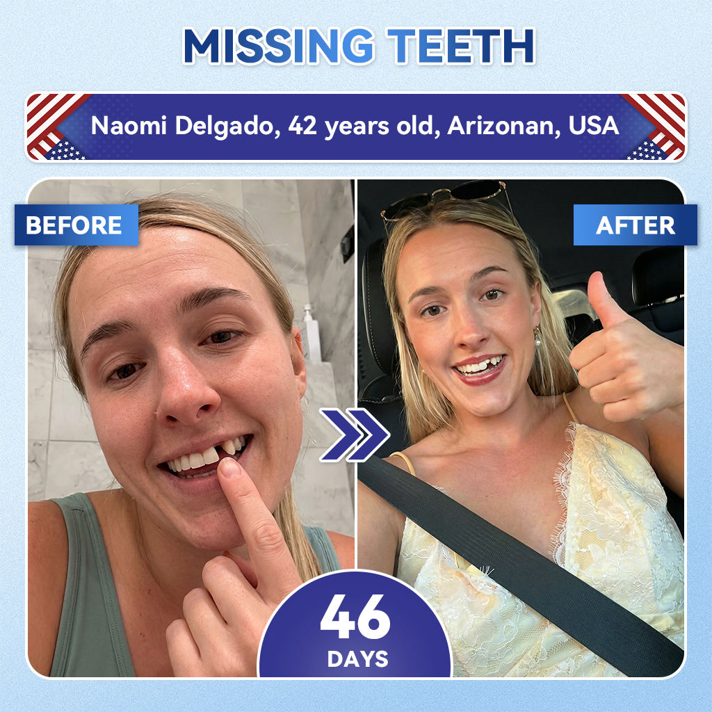 |🇺🇸 𝐎𝐟𝐟𝐢𝐜𝐢𝐚𝐥 𝐔𝐒 𝐒𝐭𝐨𝐫𝐞 | 𝐙𝐔𝐄𝐄𝐓® 🦷 Tideglusib Fast‑Dissolving Tooth & Gum Repair Oral Strips ✨ (Supports tooth repair and helps relieve gum discomfort and other common oral concerns)