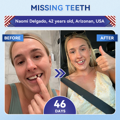 |🇺🇸 𝐎𝐟𝐟𝐢𝐜𝐢𝐚𝐥 𝐔𝐒 𝐒𝐭𝐨𝐫𝐞 | 𝐙𝐔𝐄𝐄𝐓® 🦷 Tideglusib Fast‑Dissolving Tooth & Gum Repair Oral Strips ✨ (Supports tooth repair and helps relieve gum discomfort and other common oral concerns)