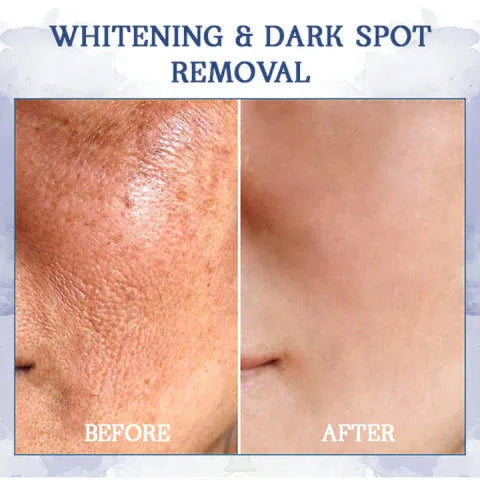 ⭐ Unwrap the Savings! Fubsta® Firming Cream Christmas Special: Take 75% OFF! 🎁