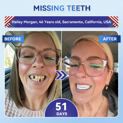 |🇺🇸 𝐎𝐟𝐟𝐢𝐜𝐢𝐚𝐥 𝐔𝐒 𝐒𝐭𝐨𝐫𝐞 | 𝐙𝐔𝐄𝐄𝐓® 🦷 Tideglusib Fast‑Dissolving Tooth & Gum Repair Oral Strips ✨ (Supports tooth repair and helps relieve gum discomfort and other common oral concerns)